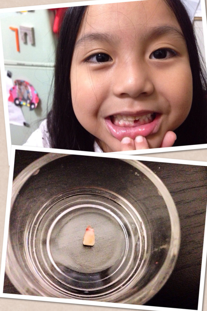 Janna's 1st tooth loss